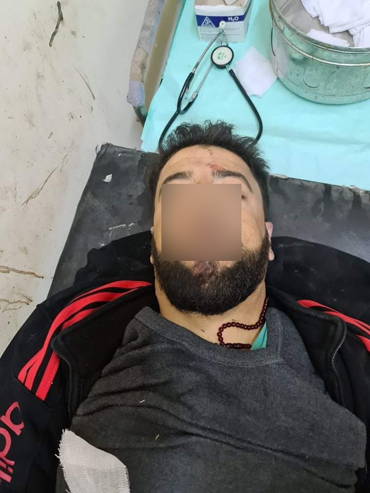 South Syria: assassinations resumed in Daraa after a week of calm. Again reconcilied Rebels are the primary targets. 3 of them were targeted in Jassem & Dael, wounding 2 & killing one (a former Shabab Sunnah commander - pic)